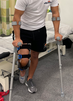 ACL Cross Bracing Method - Burleigh Physio