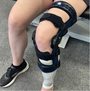 Practical Tips for Cross Bracing Protocol - Heal ACL